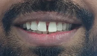 Before treatment - Case 1