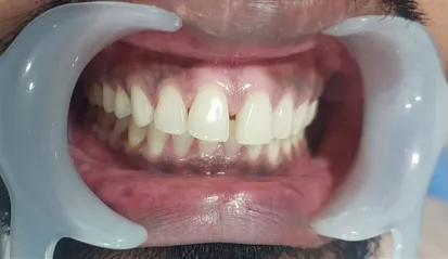 Before treatment - case 2