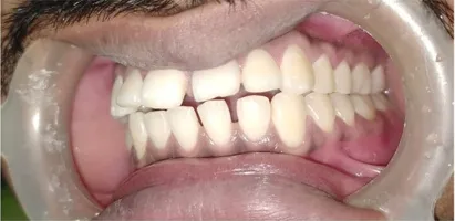 Before treatment - case 8